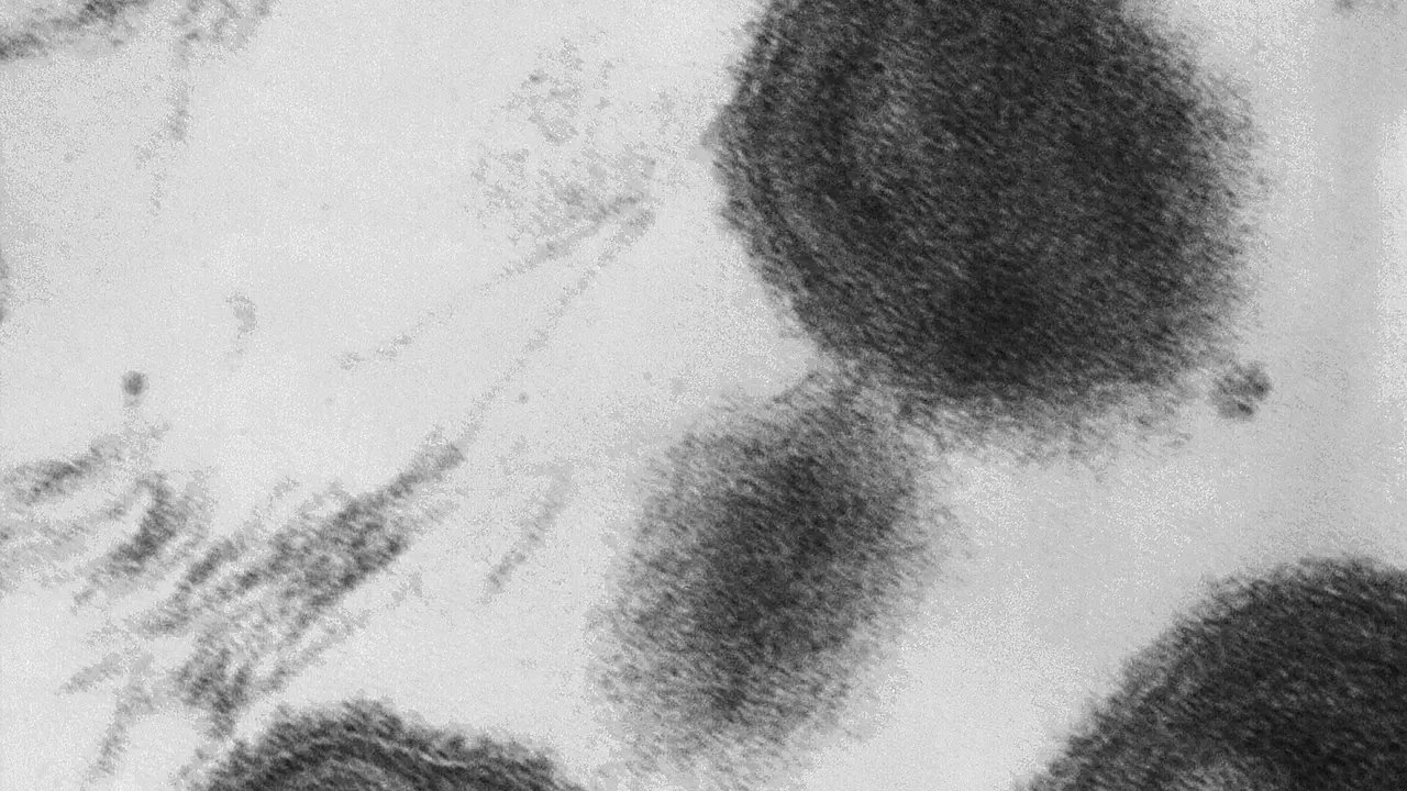 Deux momies réécrivent l’histoire de la variole : la preuve génétique qui éclaire la conquête des Amériques